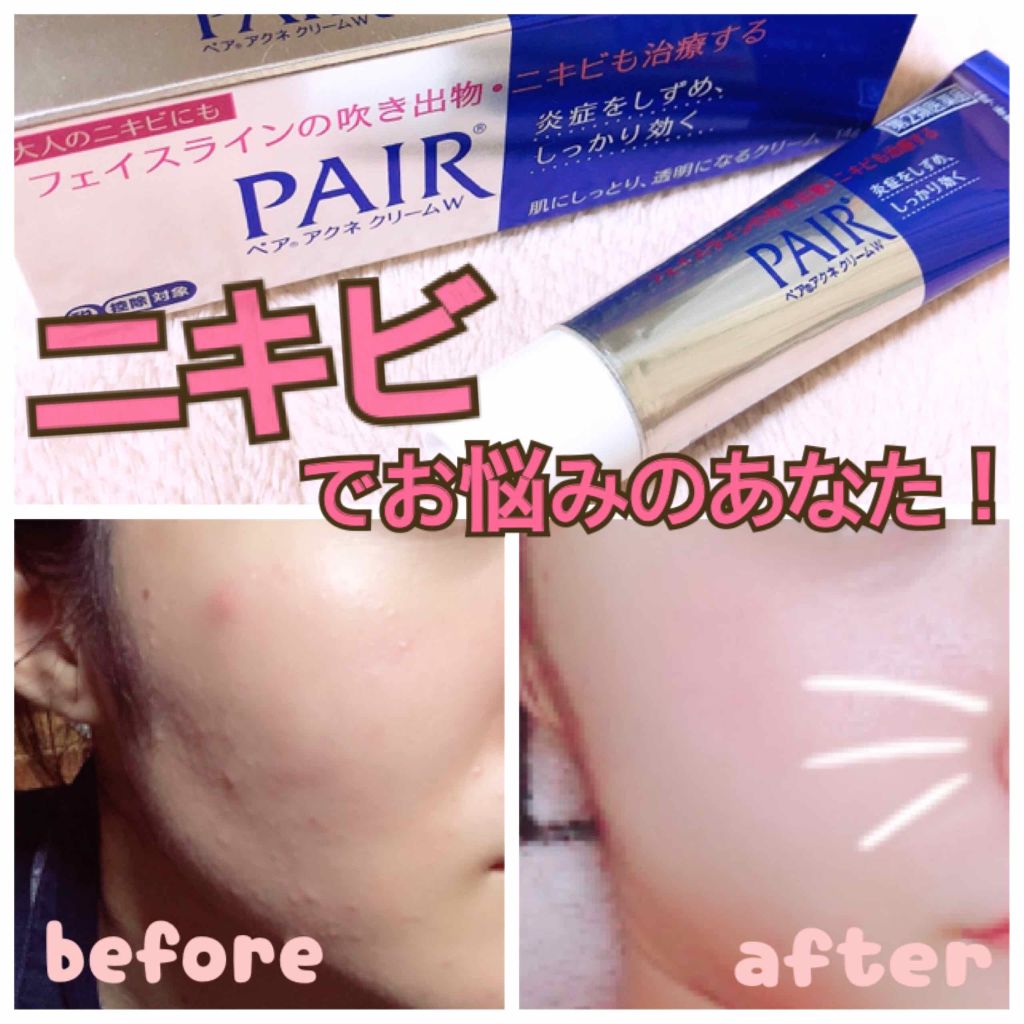 🇯🇵Japan|Analgesic and anti-inflammatory, fundamentally cures acne|PAIR Acne Medication ペアアクネクリームW