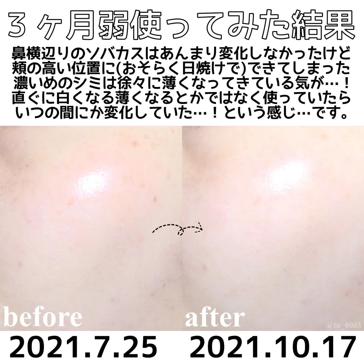 🇯🇵Japan SHISEIDO HAKU melanofocus EV Brightening Serum Whitening Serum|HAKU's finest masterpiece - Japan's No.1 for 18 consecutive years|