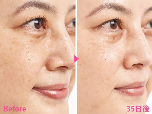 🇯🇵Japan SHISEIDO HAKU melanofocus EV Brightening Serum Whitening Serum|HAKU's finest masterpiece - Japan's No.1 for 18 consecutive years|
