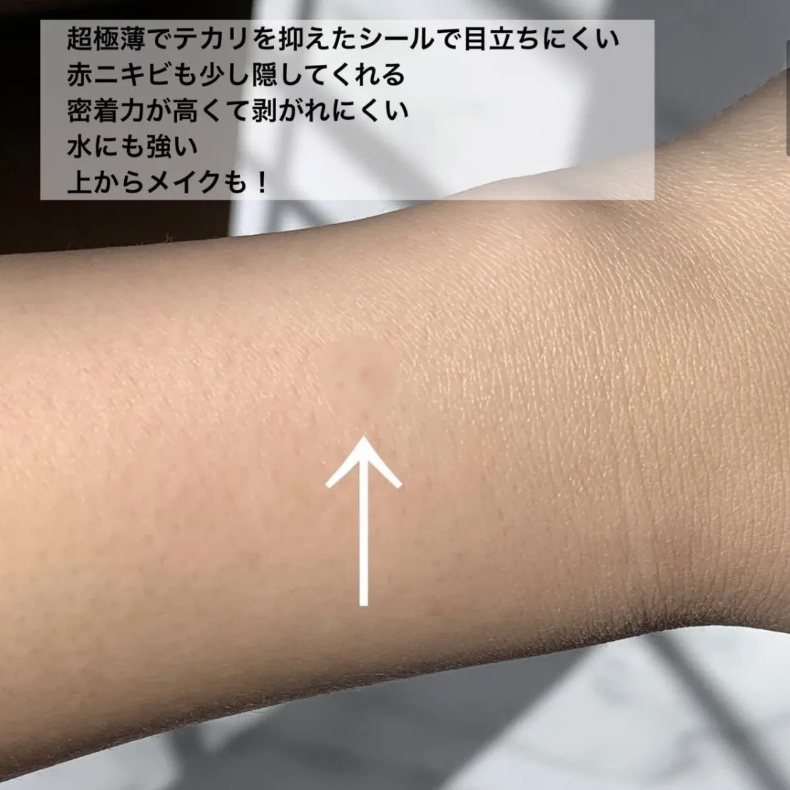 🇯🇵JAPAN ♥ KOSE CLEAR TURN Sorry Bare Skin Acne Spot Dressing Patch Pimple Stickers 日本 ごめんね素肌 藥用抗痘痘痘肌膚重點修護暗瘡貼 46枚入|薄到只得0.05mm!針對問題部位集中護理!|