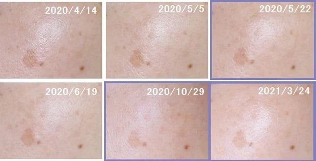 🇯🇵Japan SHISEIDO HAKU melanofocus EV Brightening Serum Whitening Serum|HAKU's finest masterpiece - Japan's No.1 for 18 consecutive years|