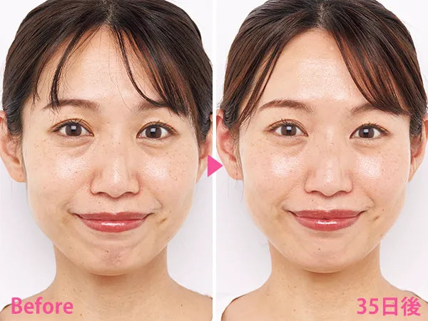 🇯🇵Japan SHISEIDO HAKU melanofocus EV Brightening Serum Whitening Serum|HAKU's finest masterpiece - Japan's No.1 for 18 consecutive years|