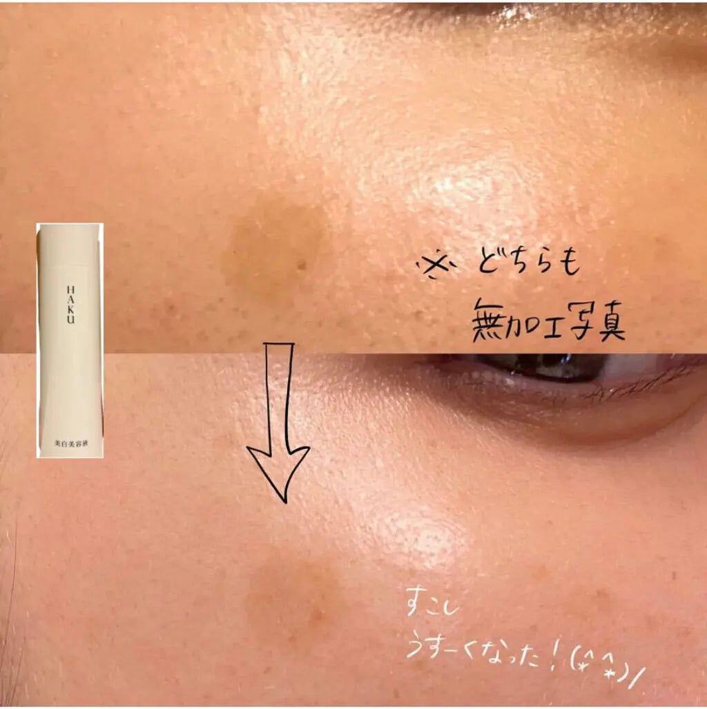 🇯🇵Japan SHISEIDO HAKU melanofocus EV Brightening Serum Whitening Serum|HAKU's finest masterpiece - Japan's No.1 for 18 consecutive years|