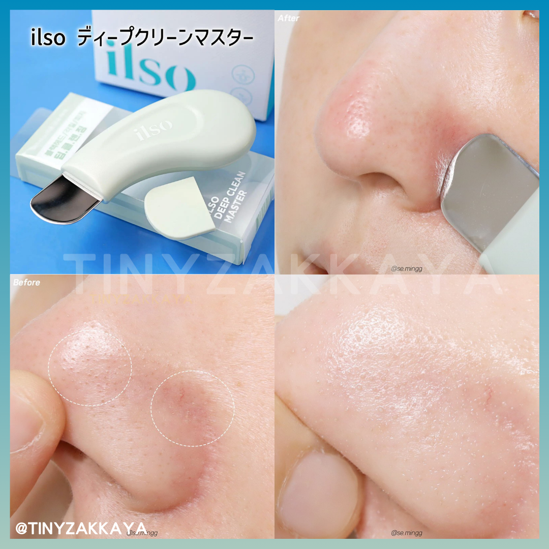 🇰🇷Korea ILSO Deep Clean Master|Apply and then scrape, blackhead-eliminating, out-of-stock | Stainless steel blackhead scraper