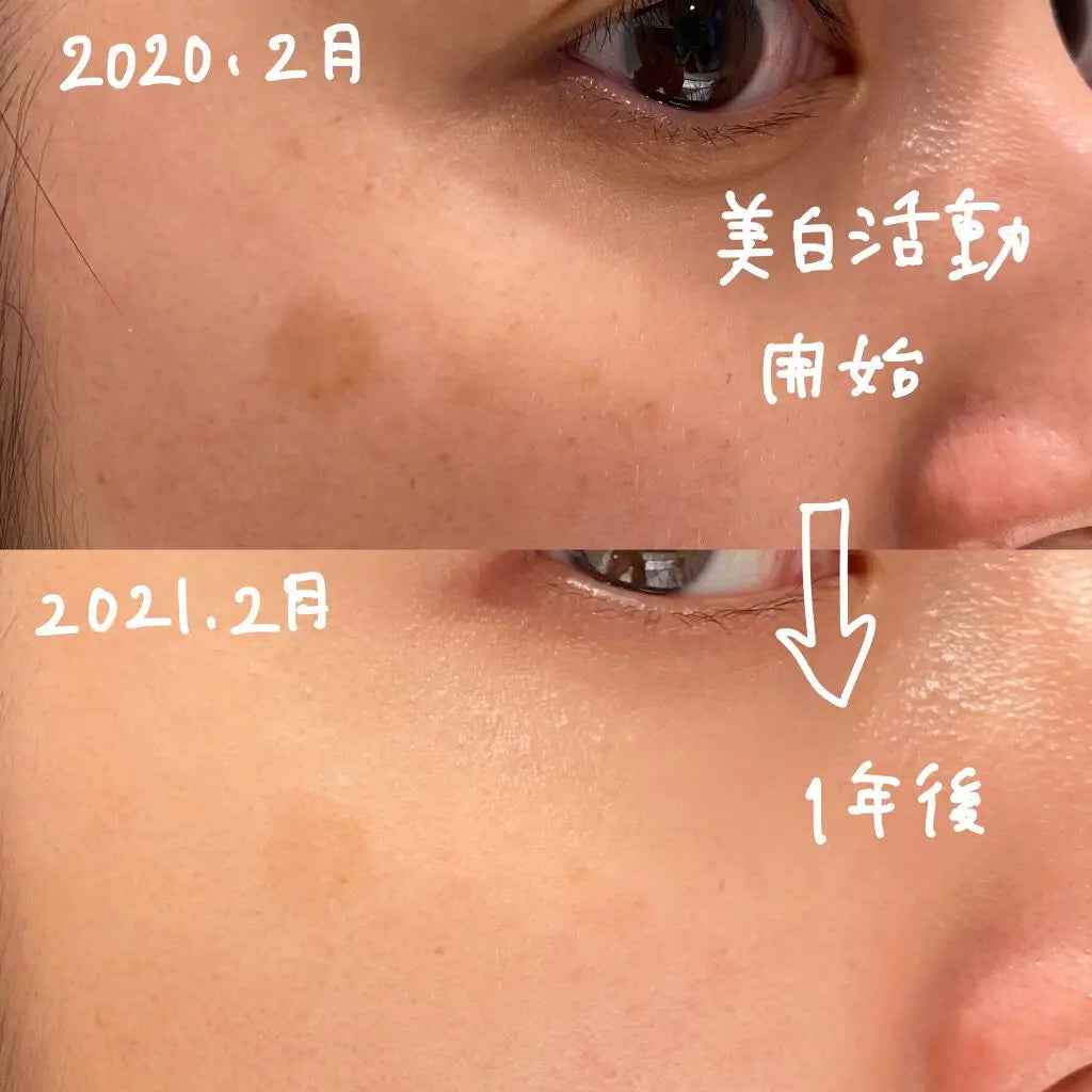🇯🇵Japan SHISEIDO HAKU melanofocus EV Brightening Serum Whitening Serum|HAKU's finest masterpiece - Japan's No.1 for 18 consecutive years|