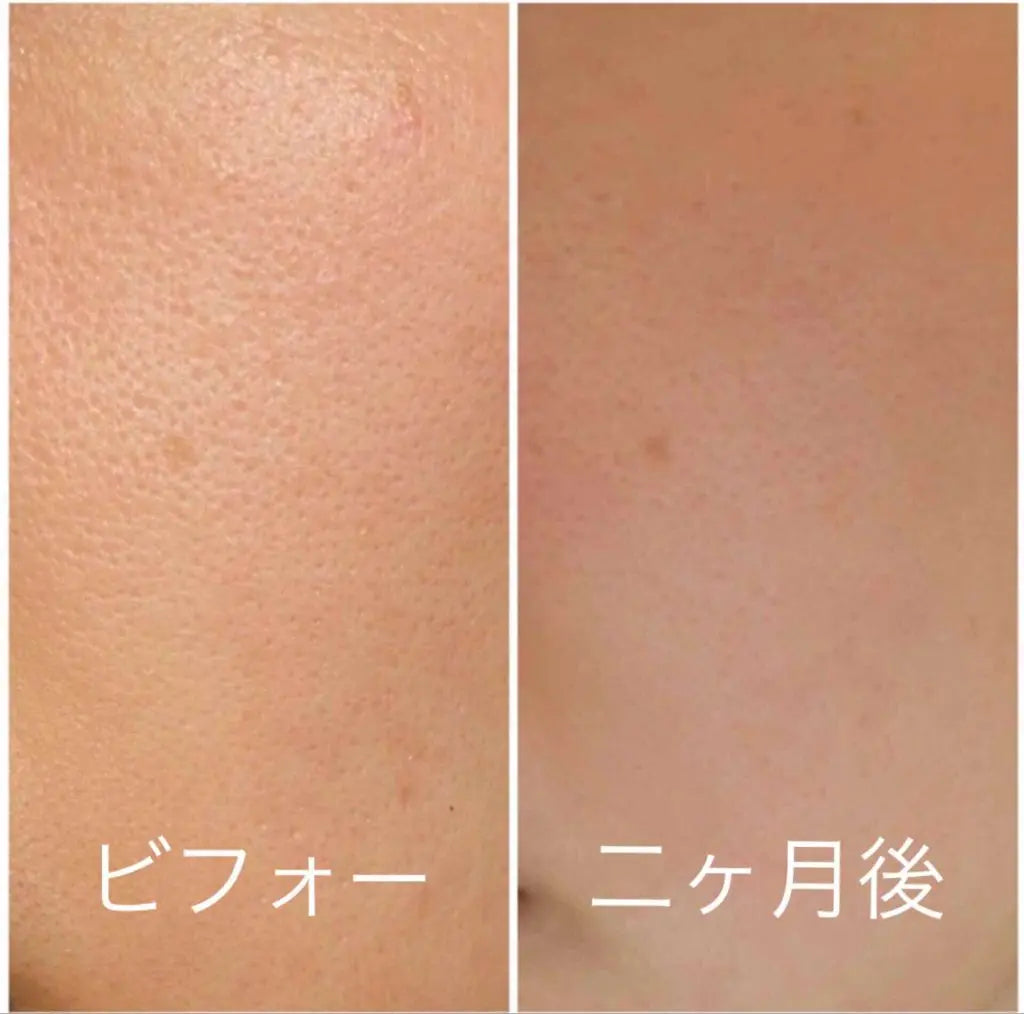 🇯🇵Japan SHISEIDO HAKU melanofocus EV Brightening Serum Whitening Serum|HAKU's finest masterpiece - Japan's No.1 for 18 consecutive years|