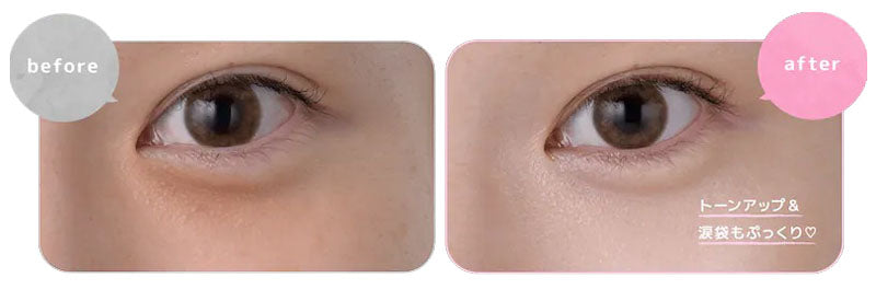 🇯🇵JAPAN ♥ Kose Clear Turn Repair Eye Cream for Sensitive Skin 20g 🇯🇵日本 ♥ 高絲 敏感肌適用去黑眼圈提亮修護眼霜  クリアターン クリアターン ごめんね素肌 クマらないアイクリーム